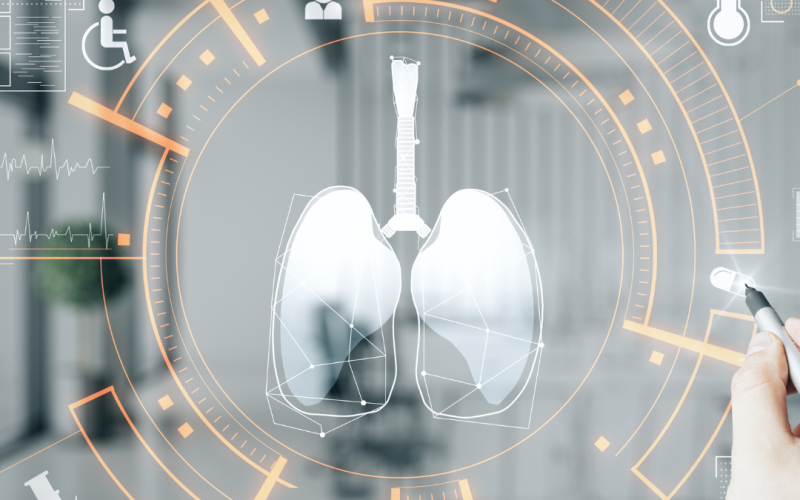 A.I. in R&D: Drug Design with A.I. Shows a Lot of Promise for Pharma